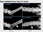 Perte de masse osseuse relie  l'ge chez la souris.