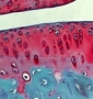 Safranin O Staining on Tibial Joint