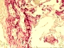 Immunohistochemical Staining - Bone Marrow