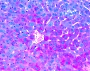 Pas Staining Liver
